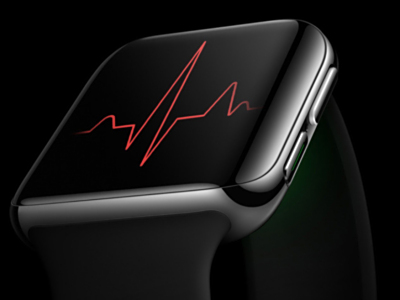 I(y)o(h)K OPPO Watch ECG_