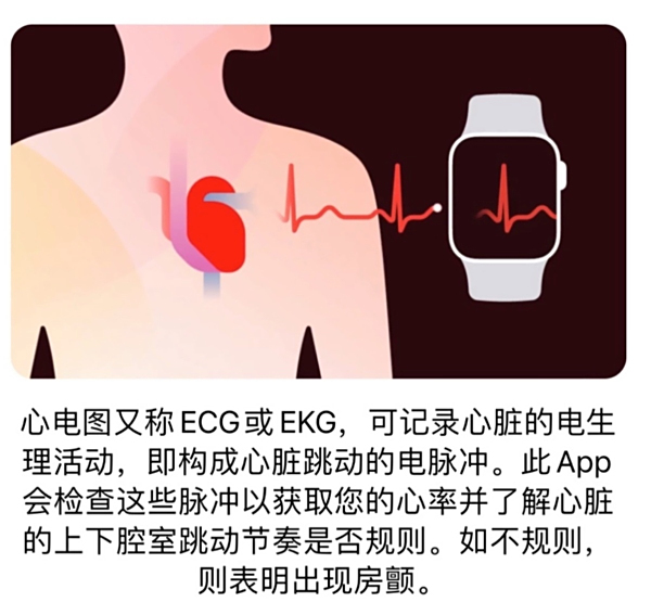 ꣬ECGĵͼͣApple Watchͨ